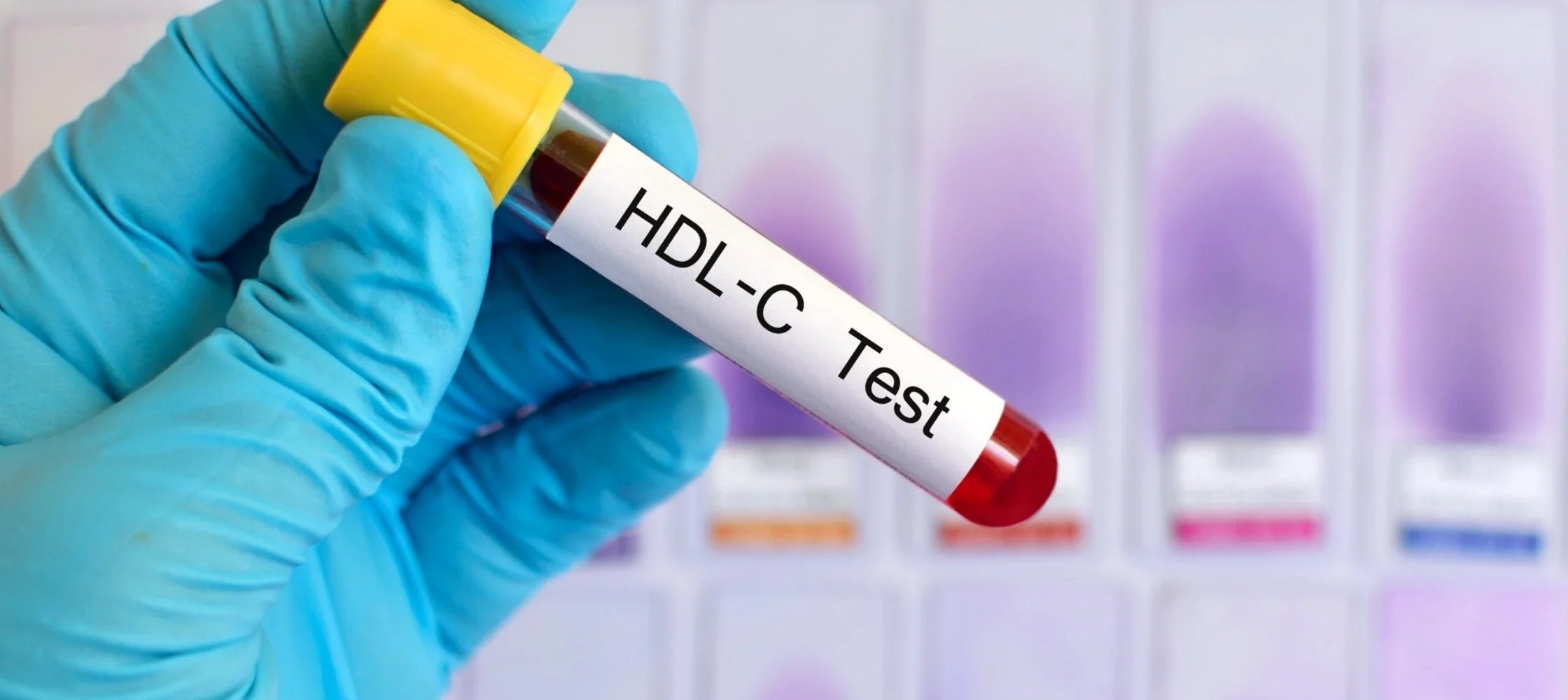 HDL cholesterol