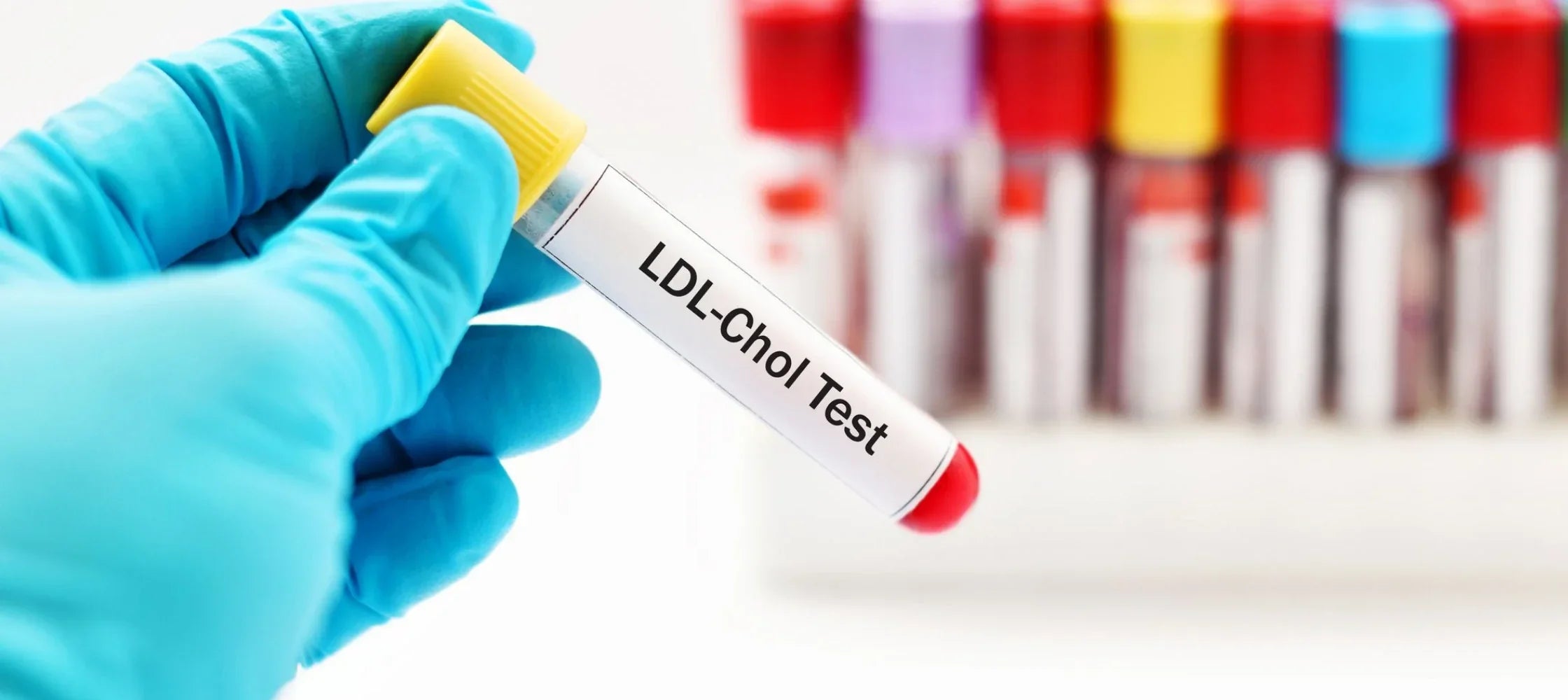 LDL cholesterol