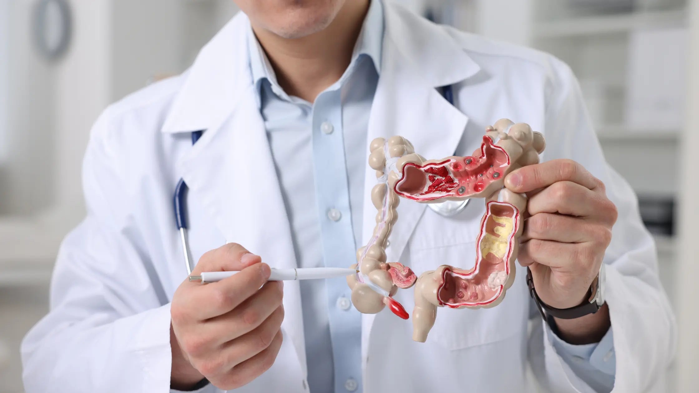 Darmflora herstellen