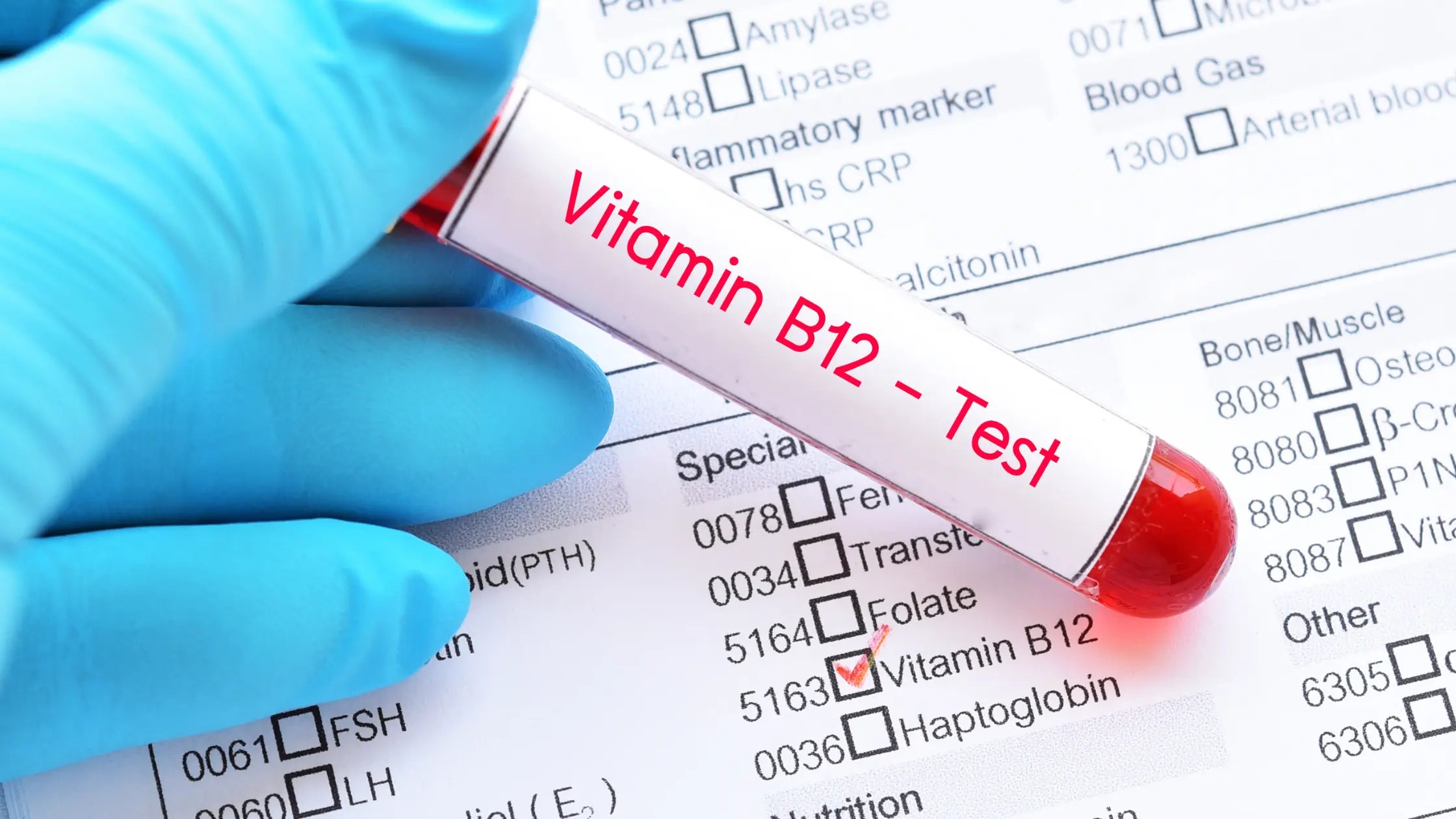 Te veel vitamine B12