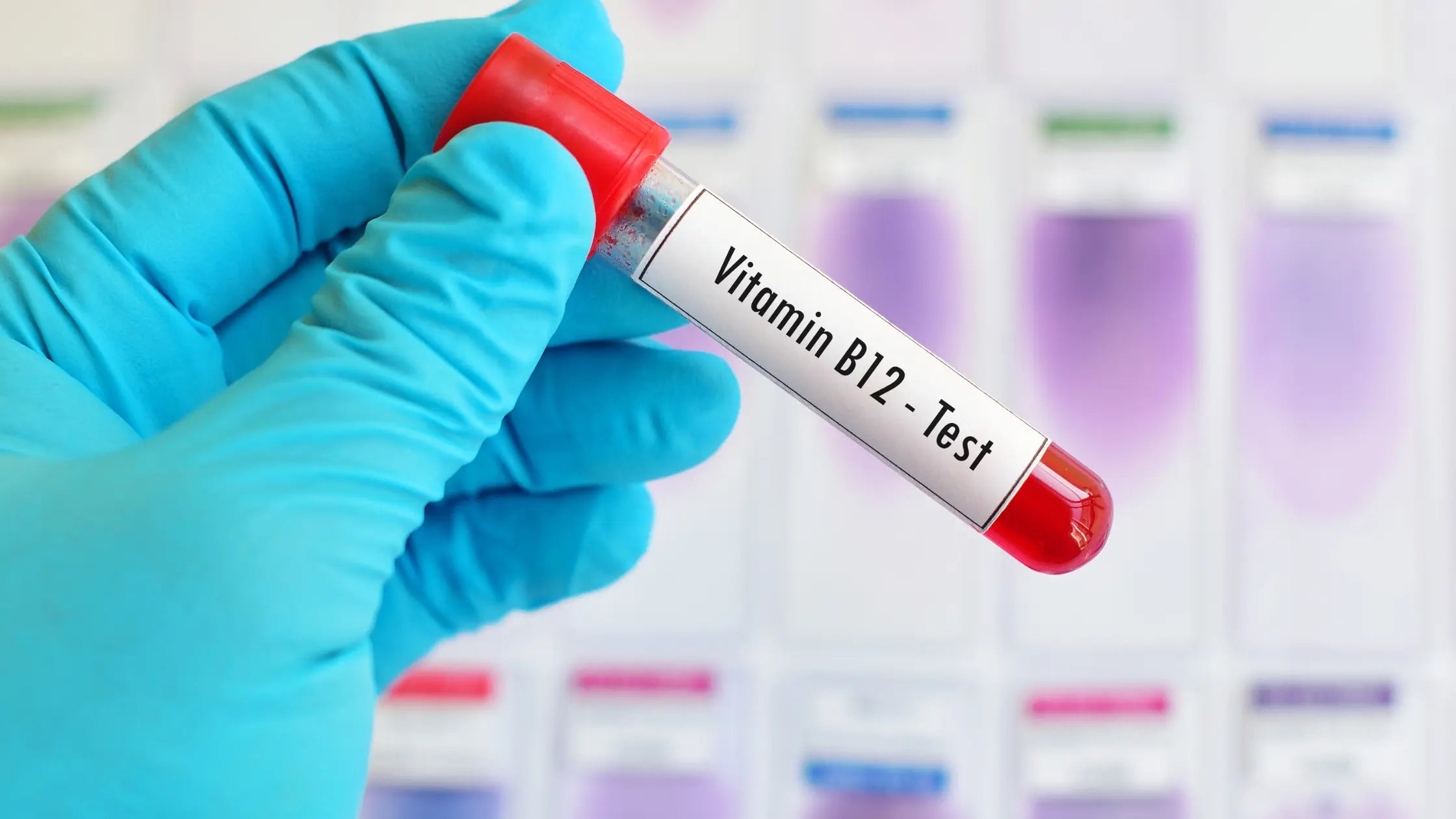 Vitamine B12 tekort