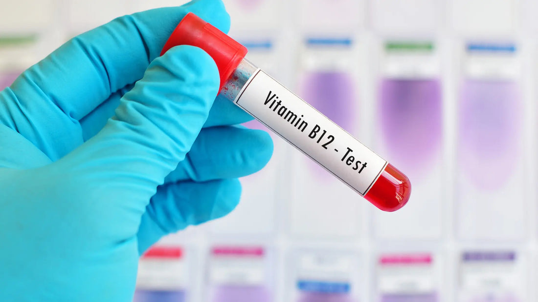 Vitamine B12 tekort